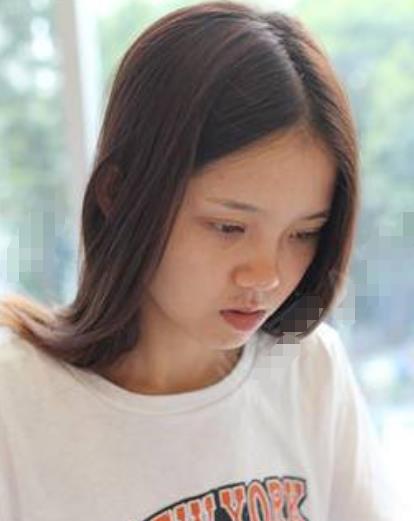 安希彤的去頸紋術(shù)前照片