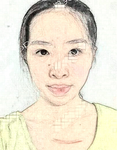 申茗之的祛疤術前照片