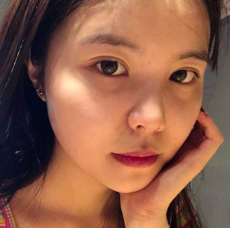 魯膺衛(wèi)的面部拉皮術(shù)前照片