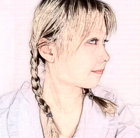 卿秋杰的磨骨瘦臉術(shù)前照片