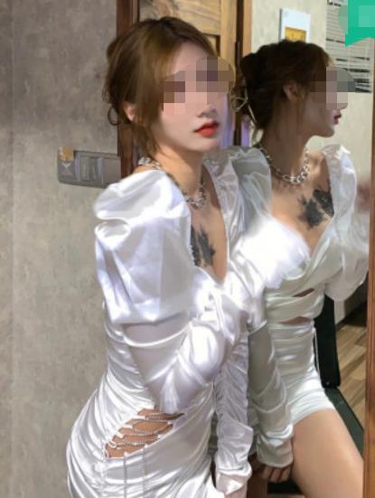 史俊馳的私密整形術(shù)前照片