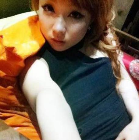 辛洋的全切雙眼皮術(shù)前照片