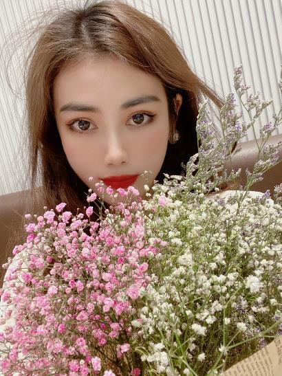 姜凱鏵的雙眼皮術(shù)后照片