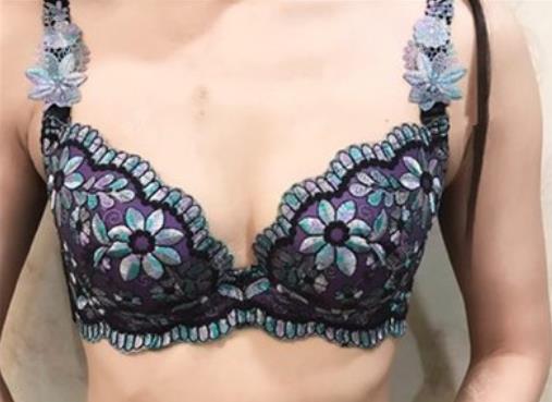 蘇至朗的假體隆胸術(shù)前照片