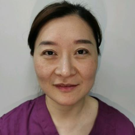 賀學(xué)婭的面部拉皮術(shù)前照片