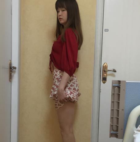 逯晴蓮的面部吸脂術(shù)前照片