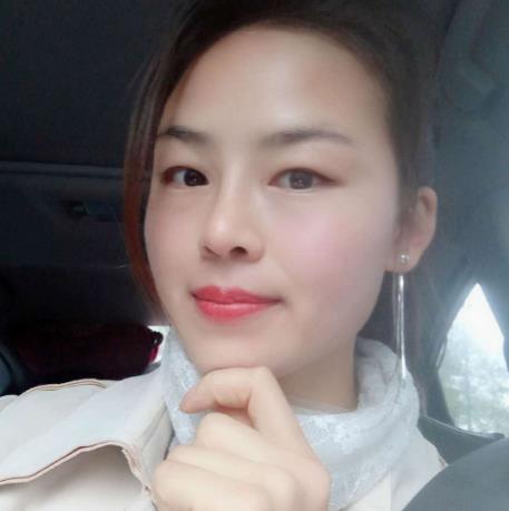 嚴(yán)奕文的隆鼻術(shù)后照片