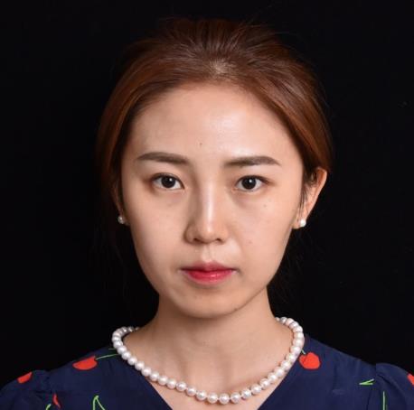 成柏於的埋線雙眼皮術(shù)前照片