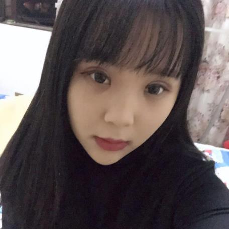 陶恩楠的雙眼皮術(shù)后照片