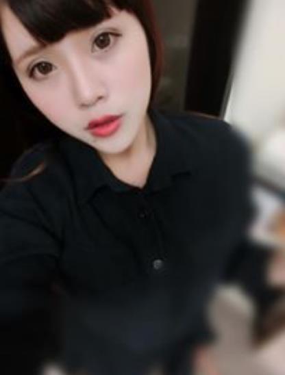 湯晨軒的瘦臉針術(shù)后照片