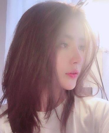 安慶施漢彬愛爾眼科醫(yī)院施漢彬醫(yī)生做鼻修復(fù)怎么樣？附鼻修復(fù)案例效果對比圖