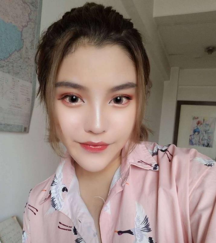 安陽修形美林整形醫(yī)院秦瑞奇醫(yī)生做隆鼻怎么樣？附隆鼻案例效果對比圖