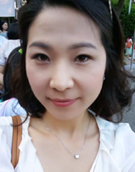 尹德潤的去眼角紋術(shù)前照片