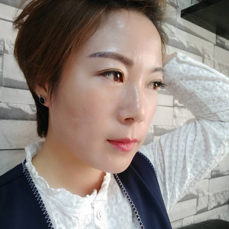 安陽姣點醫(yī)療美容門診部曹鵬飛醫(yī)生做去眼角紋怎么樣？附去眼角紋案例效果對比圖