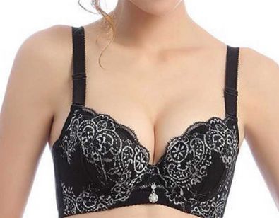 南京美萊醫(yī)生曹經棟分享雙眼皮記錄貼及價格參考