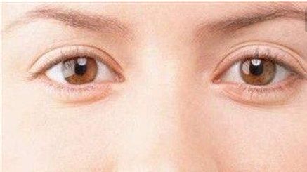 【真實(shí)案例】發(fā)現(xiàn)京城人氣醫(yī)生，術(shù)后評(píng)價(jià)驚艷！