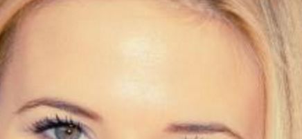 尹寧北隆鼻手術(shù)費(fèi)用價(jià)格是多少？顯貴還是親民？手術(shù)全過(guò)程詳解！