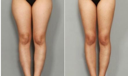 饒尚美醫(yī)美門診部主任劉芳艷，專注面部美容方案定制