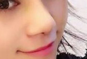 成都市第三人民醫(yī)院鼻部整形醫(yī)術(shù)集錦：葉飛輪醫(yī)生備受矚目，驚艷案例首度曝光