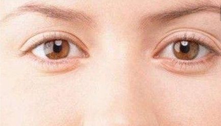 醫(yī)生雷振東的鼻部整形技術(shù)成都大華效果如何？真實案例分享