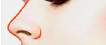 武漢協(xié)和袁泉的門診服務(wù)及隆鼻案例分享