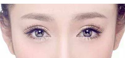 上海余東雙眼皮修復，效果怎么樣？余東與徐小菲相比，哪個更受歡迎？