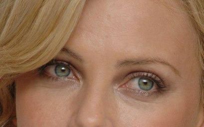 沈陽(yáng)陸軍總院去除眼袋效果如何？醫(yī)生技術(shù)值得信賴！從案例看去眼袋效果