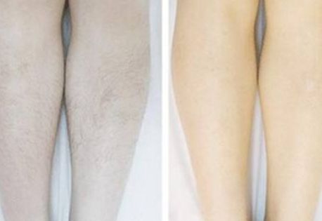 山城整形科，鼻部整形效果被大量親測案例證實