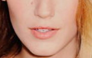 武漢同濟(jì)醫(yī)院：探密私密整形科的完美效果！震撼2023陰道緊縮案例公開！