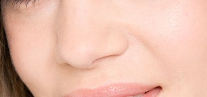 北京八大處整形醫(yī)院宋濤博士：憑借優(yōu)秀的技術(shù)和成功的隆鼻案例，在整形行業(yè)大放異彩！