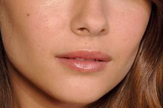 北京李傳康醫(yī)生雙眼皮術(shù)的出色效果，2023年令人驚嘆的案例發(fā)布