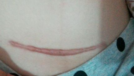 上海9醫(yī)院植入豐胸手術(shù)價(jià)格與技術(shù)解析列表