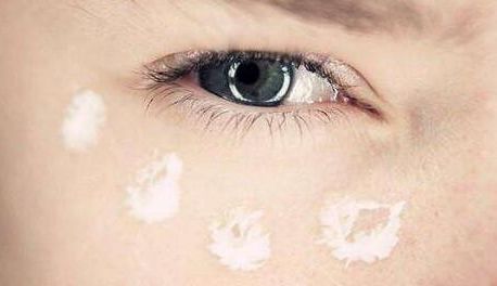 同濟醫(yī)院任玉萍醫(yī)生值得信賴？探秘武漢受歡迎整形專家提供的案例與資料