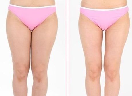 貴陽隆胸手術(shù)技術(shù)如何選擇？五位專家推薦！