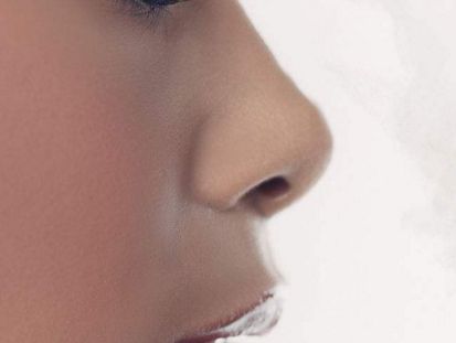 煙臺曹品根醫(yī)生90天雙眼皮修復案例一覽，效果驚艷！