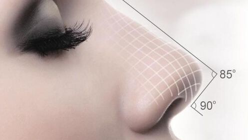 突破查詢限制！深圳藝星整形醫(yī)院經(jīng)驗與醫(yī)療名師共同分享，自體脂肪隆胸案例淺析