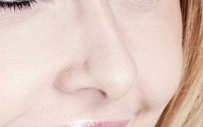 東莞華美美容醫(yī)院主治專家揭秘：主任醫(yī)師手法高明、臨床經(jīng)驗(yàn)豐富案例分享