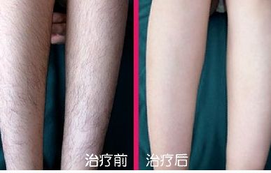 整形醫(yī)生蘇凱、男神張真、王杰大夫誰在鼻部修復(fù)領(lǐng)域頗具聲望？