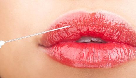 李正勇醫(yī)生乳房整形的最新進展，2023案例盡在眼前