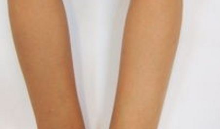 蘭州市人民醫(yī)院皮膚科專家資源揭秘