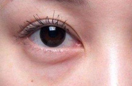 南京隆鼻術(shù)咨詢：熱門(mén)醫(yī)生推薦名單發(fā)布！備受歡迎的專(zhuān)家！