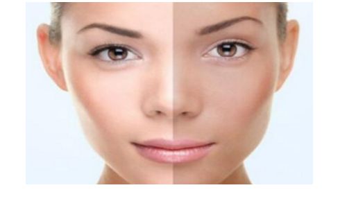 上海伊萊美邱文苑：精湛技藝呈現眼睛完美修復效果