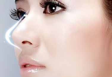 上海美姿整形醫(yī)院周濱醫(yī)生的隆鼻案例展示與患者反饋