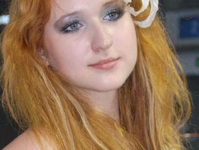 九江風(fēng)華醫(yī)療美容門診部：經(jīng)典案例分享，偷走你的目光！