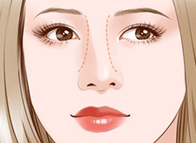 雙眼皮美容手術在蘭州亞韓整形醫(yī)院如何呢？