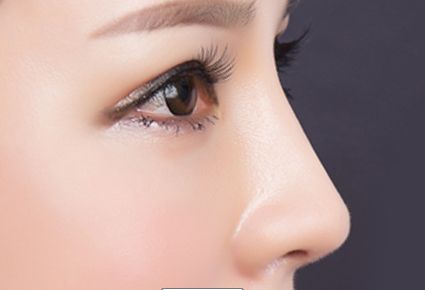 哈爾濱王濱福雙眼皮技術如何？專家簡介和成功案例展示！