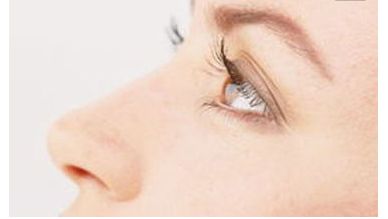 上海瑞歐醫(yī)療美容醫(yī)院獨創(chuàng)面部吸脂技術(shù)呈現(xiàn)全新案例