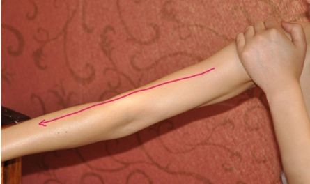 黃海濱醫(yī)生的技術(shù)水平如何？分享我的隆鼻手術(shù)全過(guò)程！