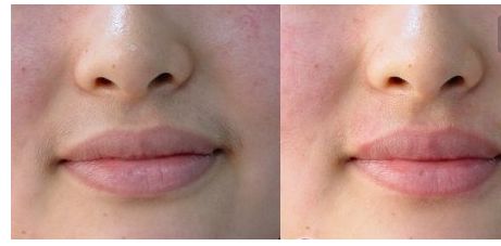 北京八大處整容醫(yī)師公開(kāi)名單，診所概況與照片案例解析