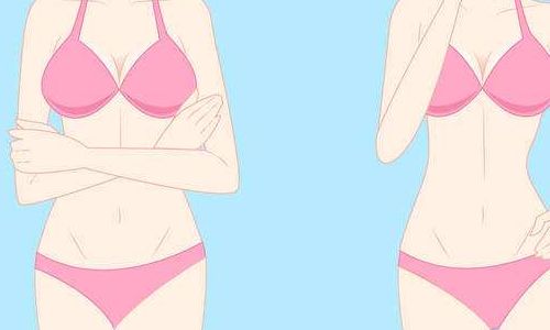 石杭燕雙眼皮技術(shù)解析，專家分享過程與效果